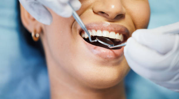 Best Emergency Dental Care for Broken or Chipped Teeth in Mart, TX